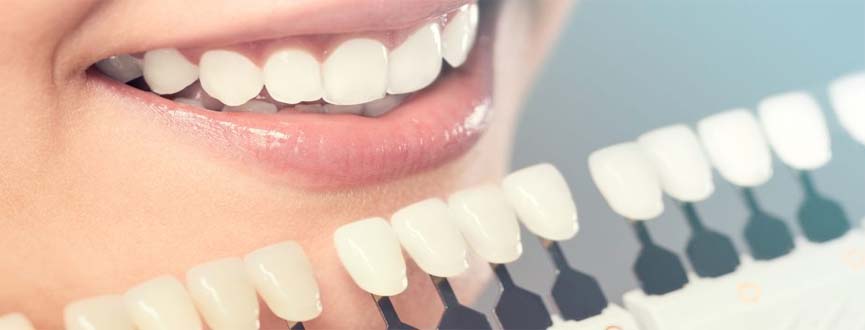 Cosmetic Dental Treatment in Ahmedabad