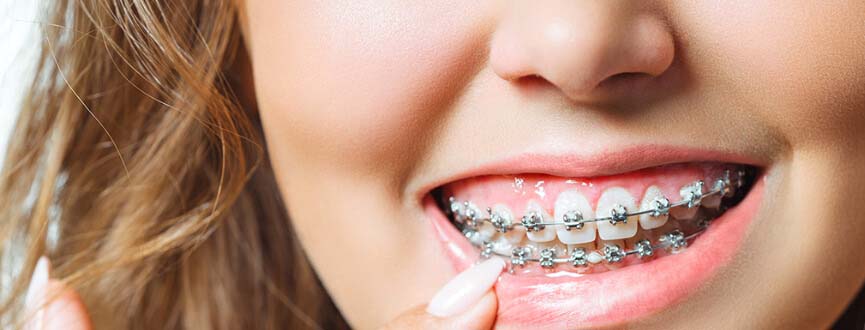 Orthodontic Treatment in Ahmedabad